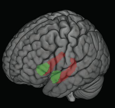 Click to enlarge stress effect on brain