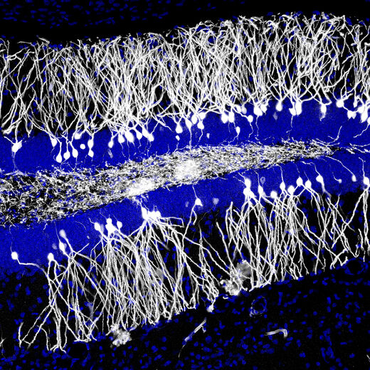 Click to enlarge neurons
