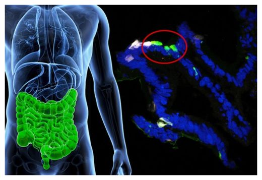 GI Cells