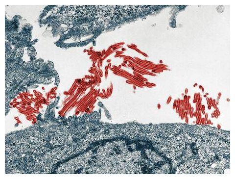 H1N1 flu virus