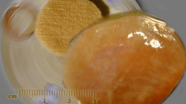 Click to enlarge Frankenfood1