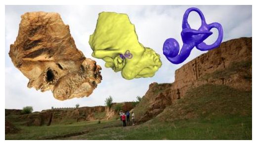  Temporal bone