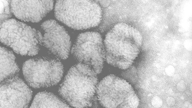 smallpox