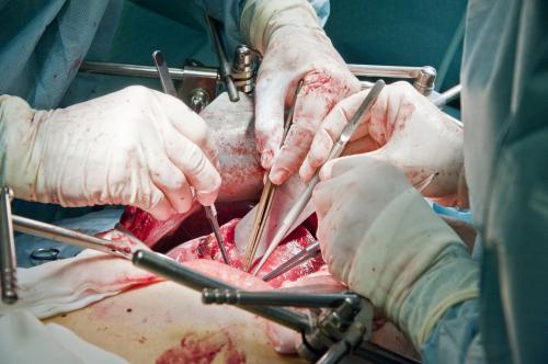 Liver Transplant