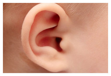 Click to enlarge Ear