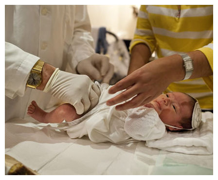 Circumcision