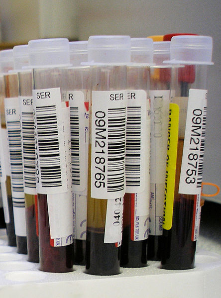 Blood Samples