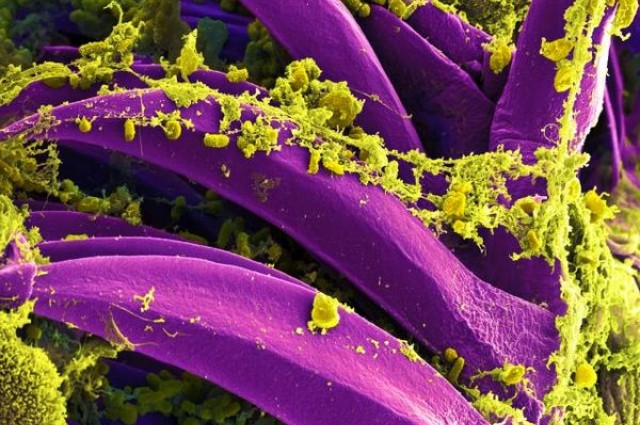 Click to enlarge plague causing bacteria Y. pestis