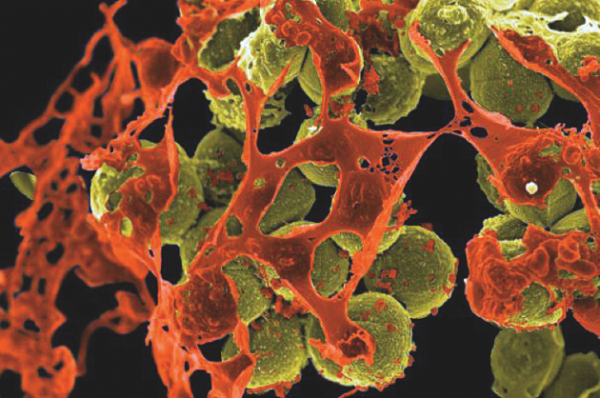 superbug CRE