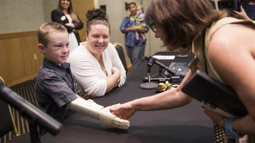 3D printer prosthetic arm