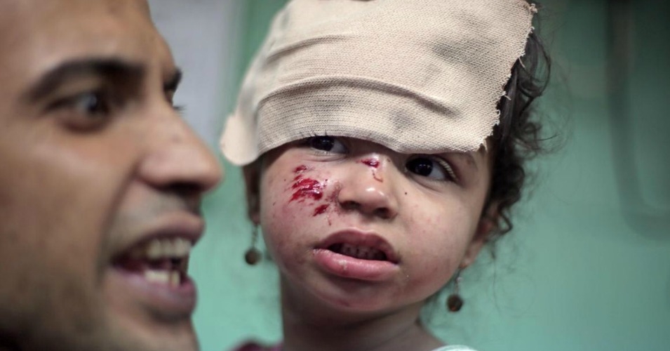 wouned palestinian girl