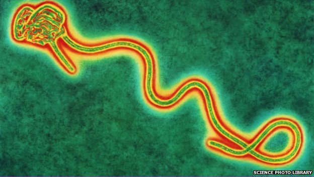 ebola virus