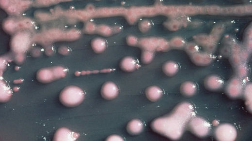  CRE bacteria