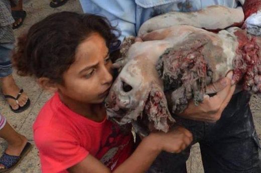 Dead Child Gaza