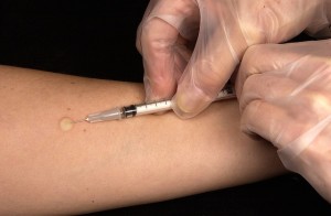 Ebola Vaccine