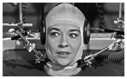 Head Transplant